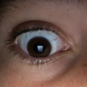 A Glass Eyeball